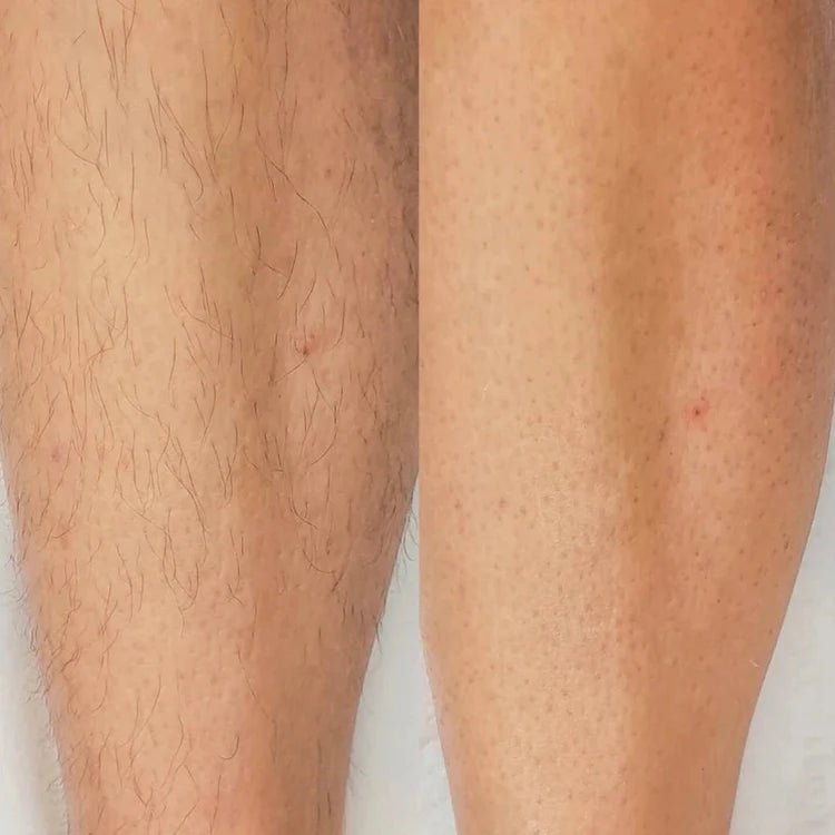 TenderTemps™ Tıraş Makinesi
