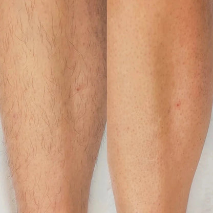 TenderTemps™  Tıraş Makinesi
